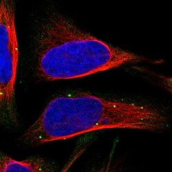 Inhibin alpha Antibody, Novus Biologicals 25 &mu;L; Unlabeled:Antibodies,
